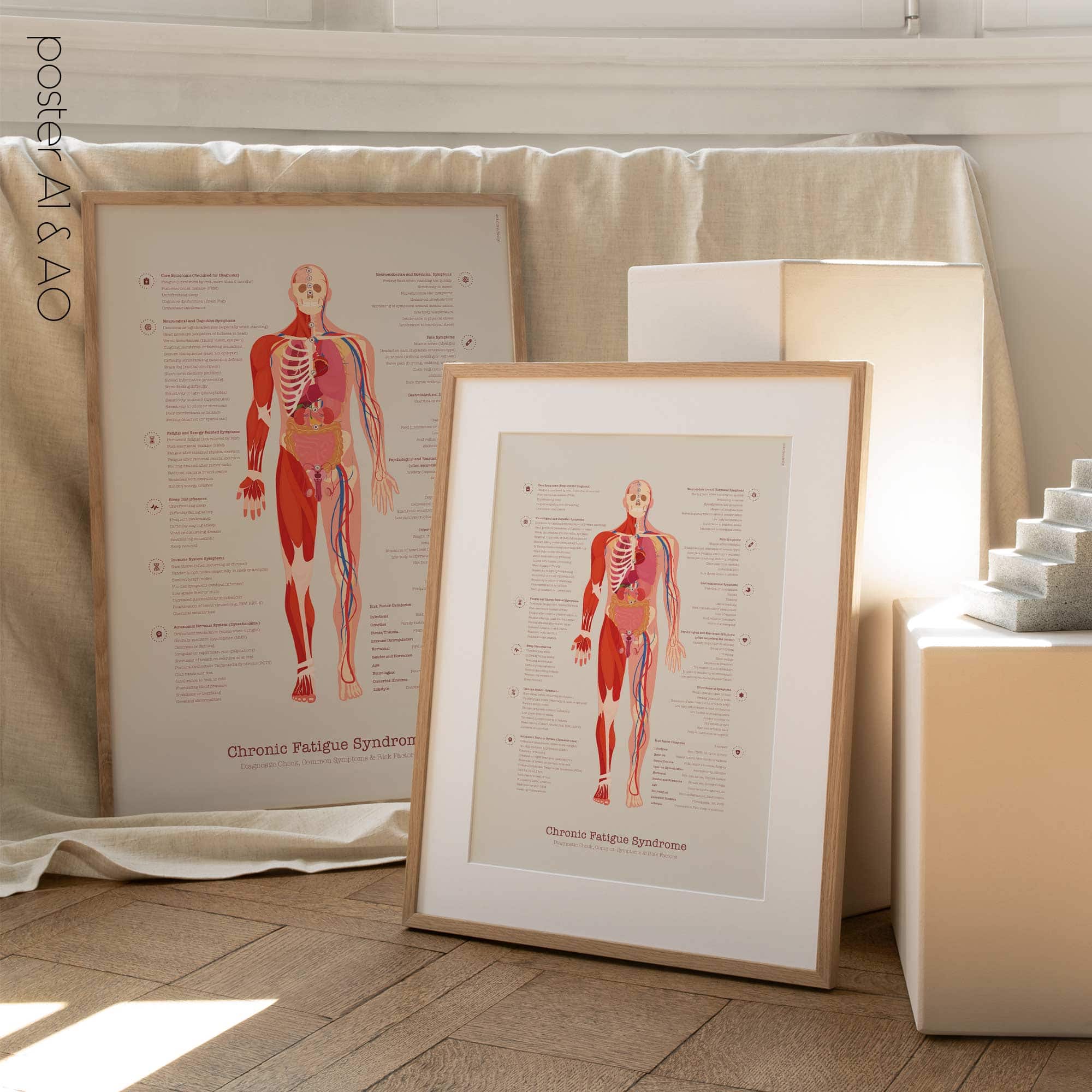 Chronic Fatigue Sindrome chart with Diagnostic Check, Common Symptoms & Risk Factors