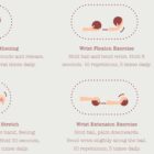 Carpal Tunnel Syndrome with Diagnosis and Exercises