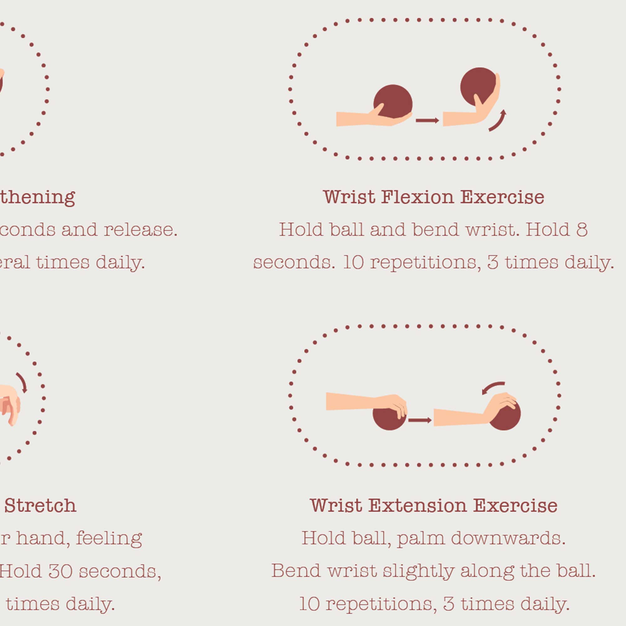 Carpal Tunnel Syndrome with Diagnosis and Exercises