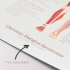 Chronic Fatigue Sindrome chart with Diagnostic Check, Common Symptoms & Risk Factors