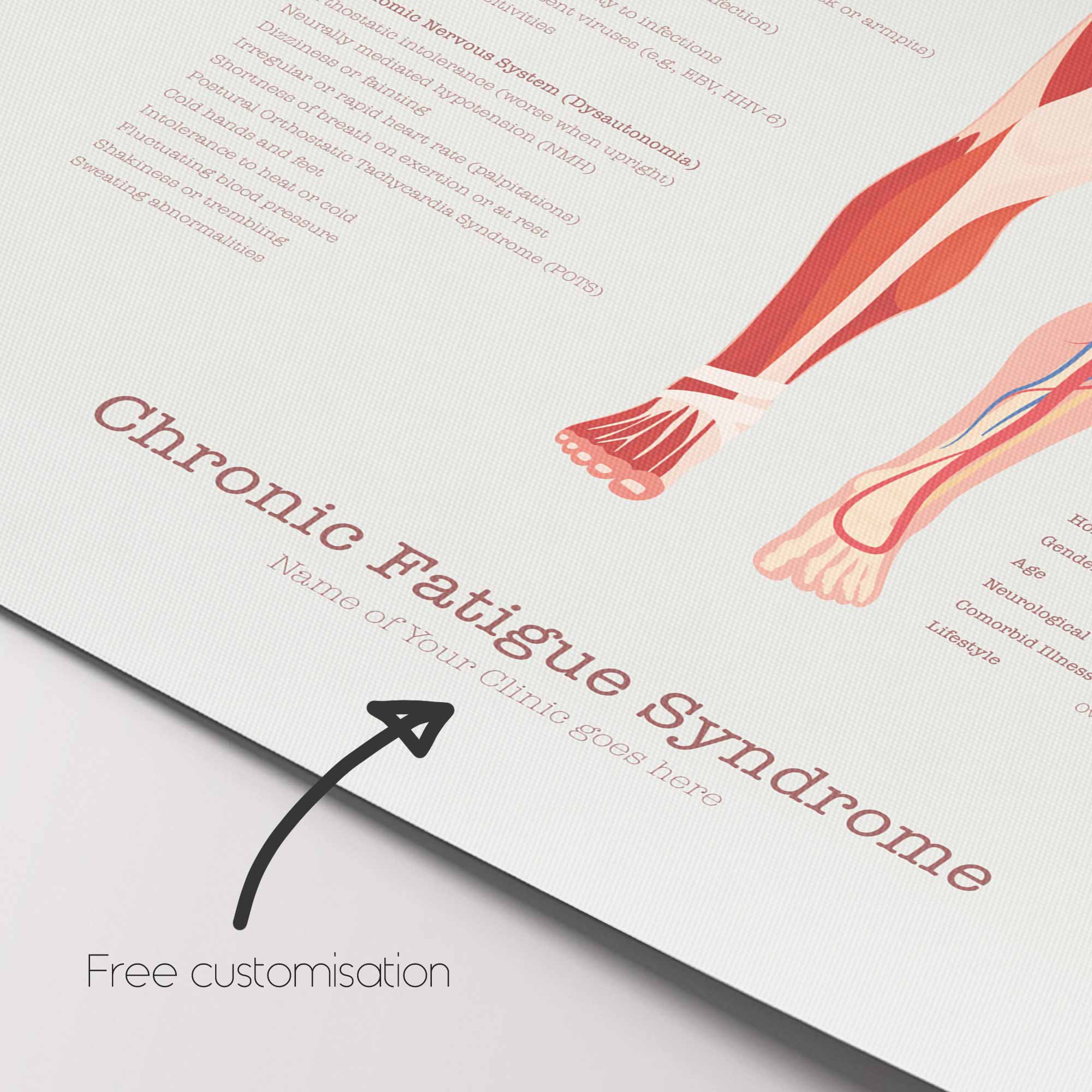 Chronic Fatigue Sindrome chart with Diagnostic Check, Common Symptoms & Risk Factors