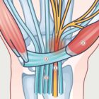 Carpal Tunnel Syndrome with Diagnosis and Exercises