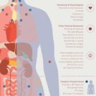 Fibromyalgia with Hormonal and Nervous System Connections anatomy chart for clinics Fibromyalgia with Hormonal and Nervous System Connections anatomy chart for clinics