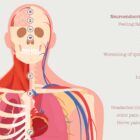 Chronic Fatigue Sindrome chart with Diagnostic Check, Common Symptoms & Risk Factors