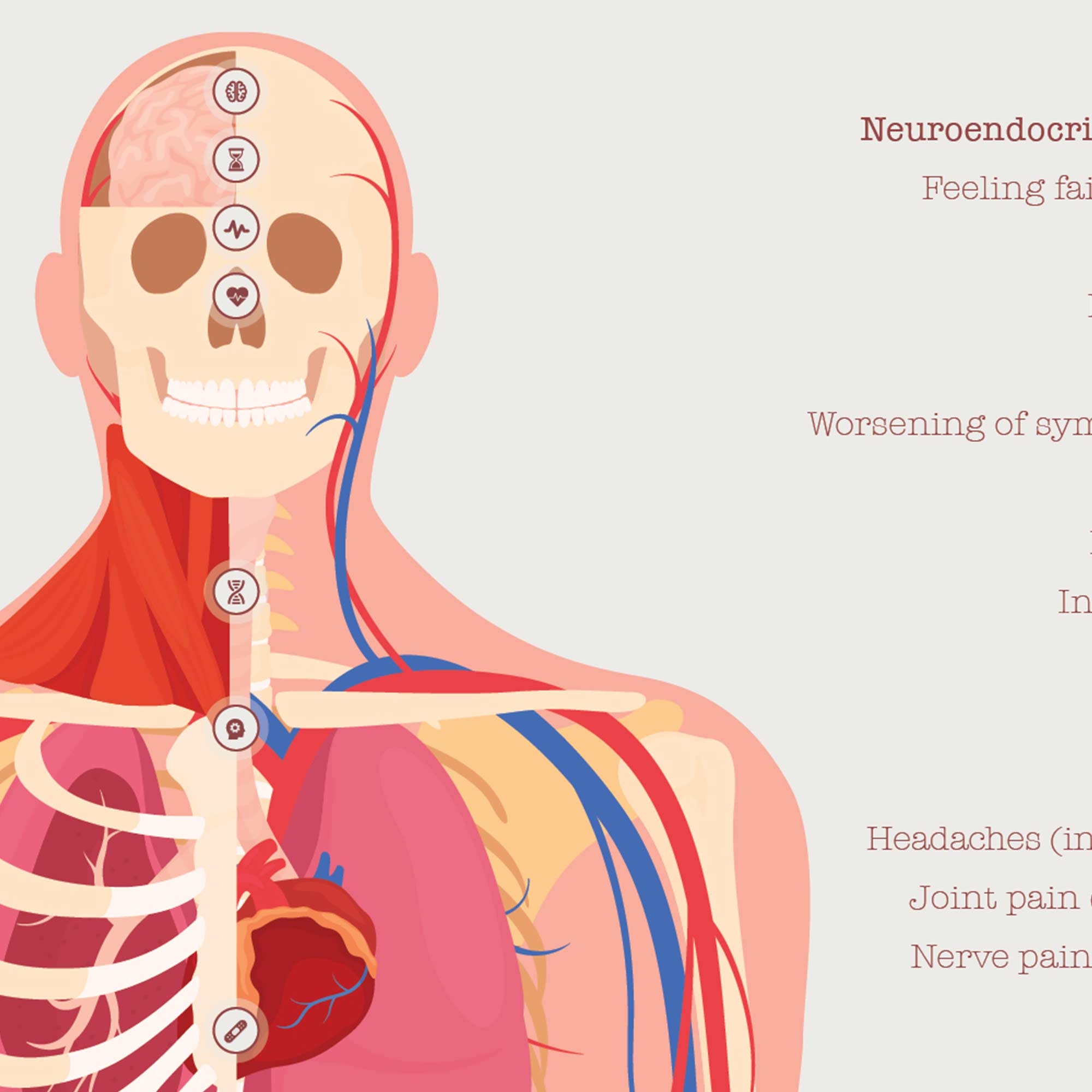 Chronic Fatigue Sindrome chart with Diagnostic Check, Common Symptoms & Risk Factors