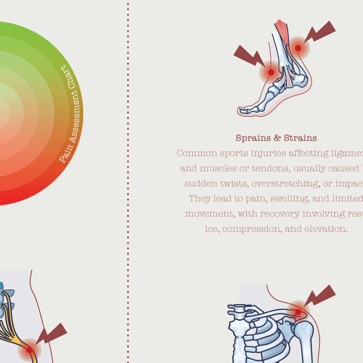 Sports Injuries poster with recovery and pain assessment chart.