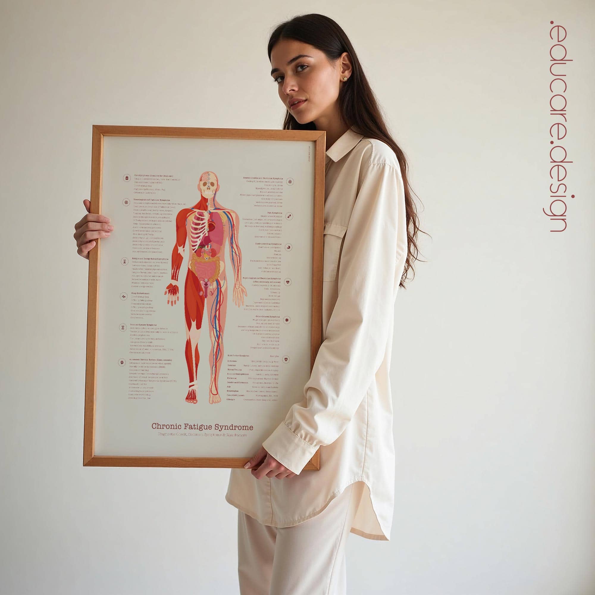 Chronic Fatigue Sindrome chart with Diagnostic Check, Common Symptoms & Risk Factors