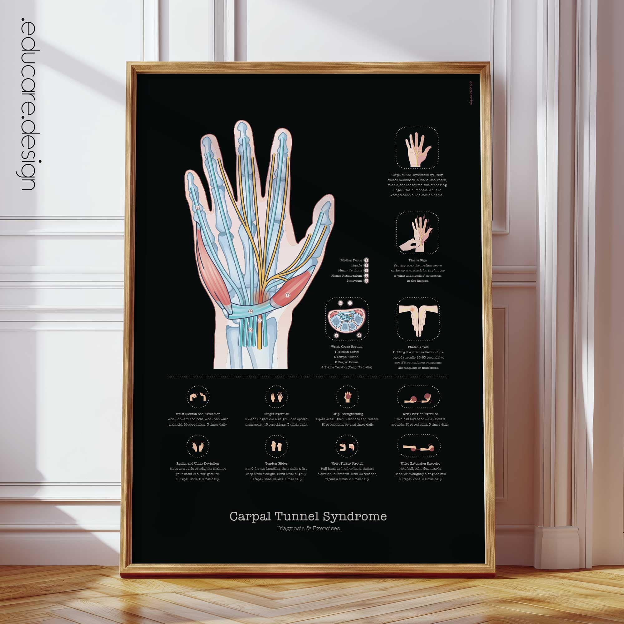 Carpal Tunnel Syndrome and Exercises Chart, Black Edition