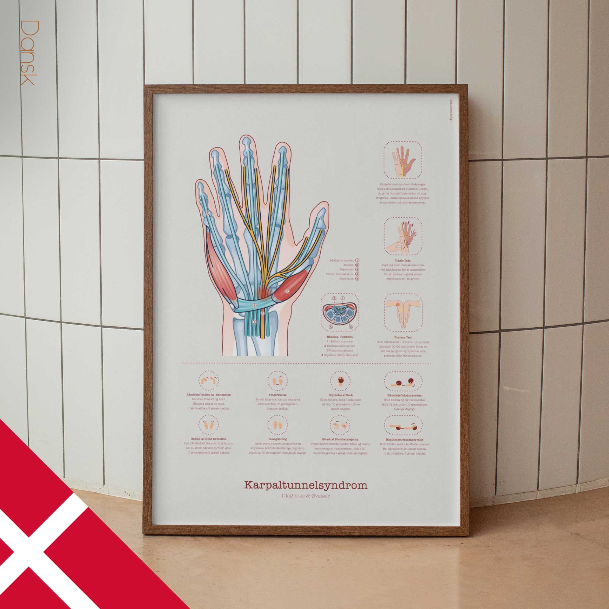 Carpal Tunnel Syndrome with Diagnosis and Exercises