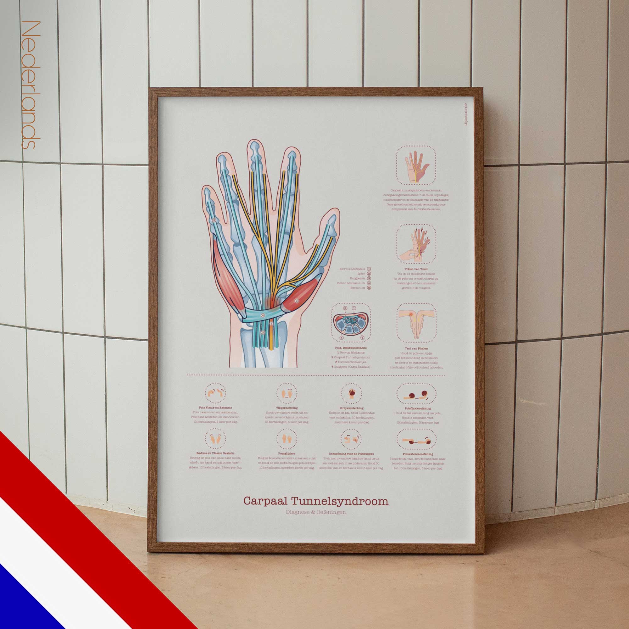 Carpal Tunnel Syndrome with Diagnosis and Exercises