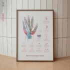 Carpal Tunnel Syndrome with Diagnosis and Exercises