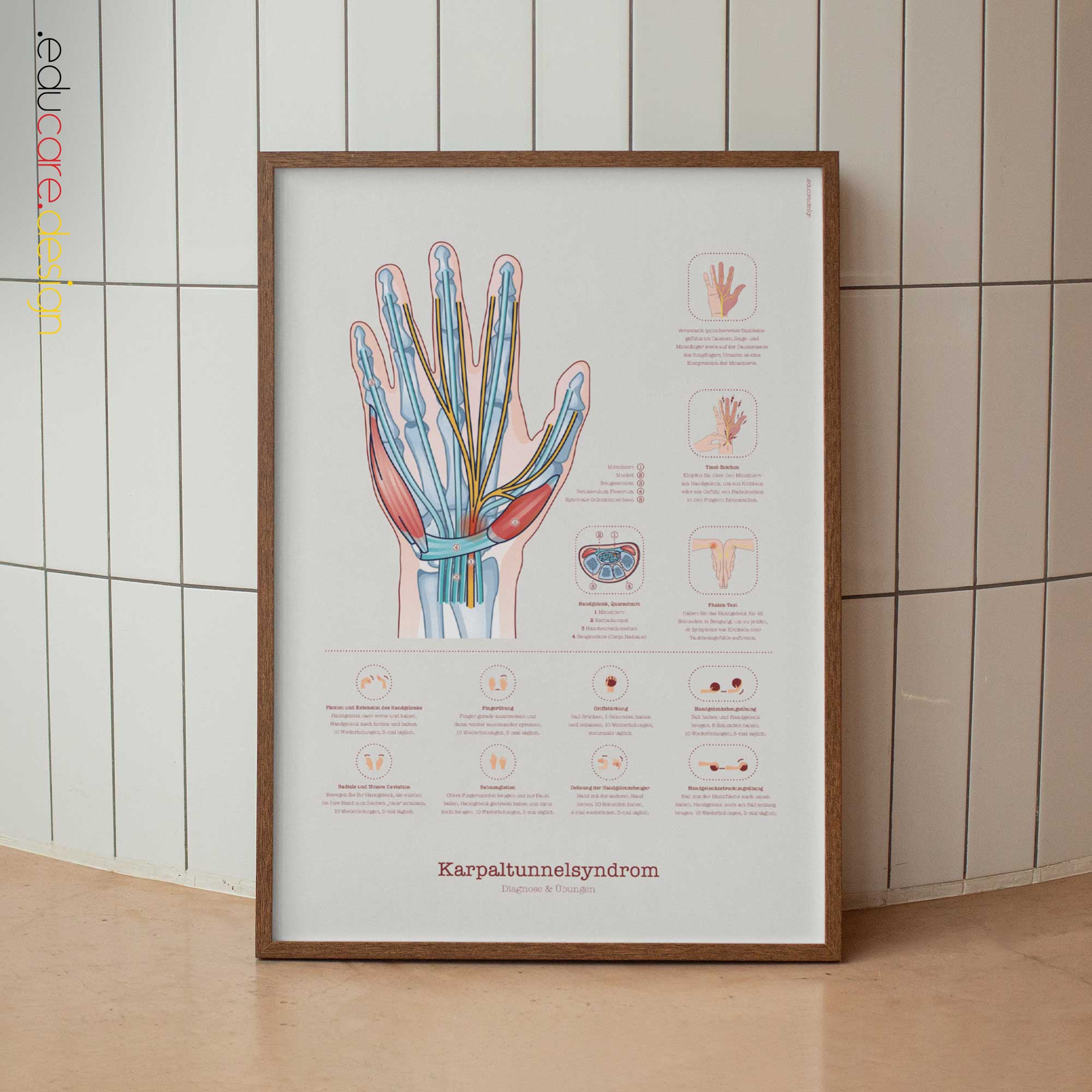 Karpaltunnelsyndrom, Diagnose & Übungen