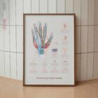 Carpal Tunnel Syndrome with Diagnosis and Exercises