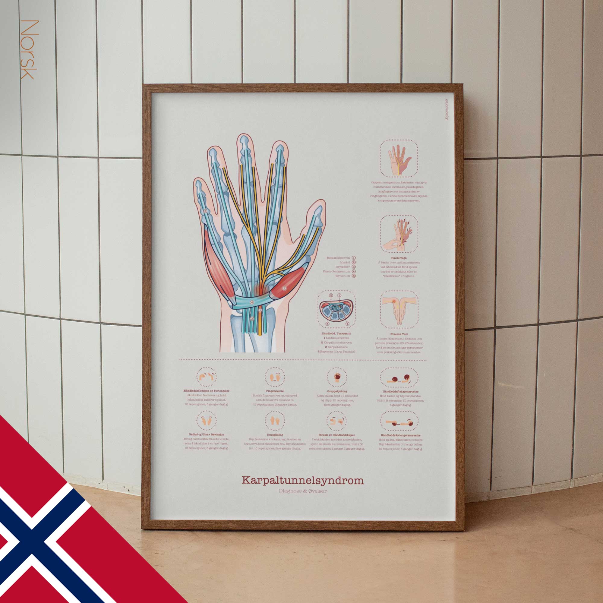 Carpal Tunnel Syndrome with Diagnosis and Exercises