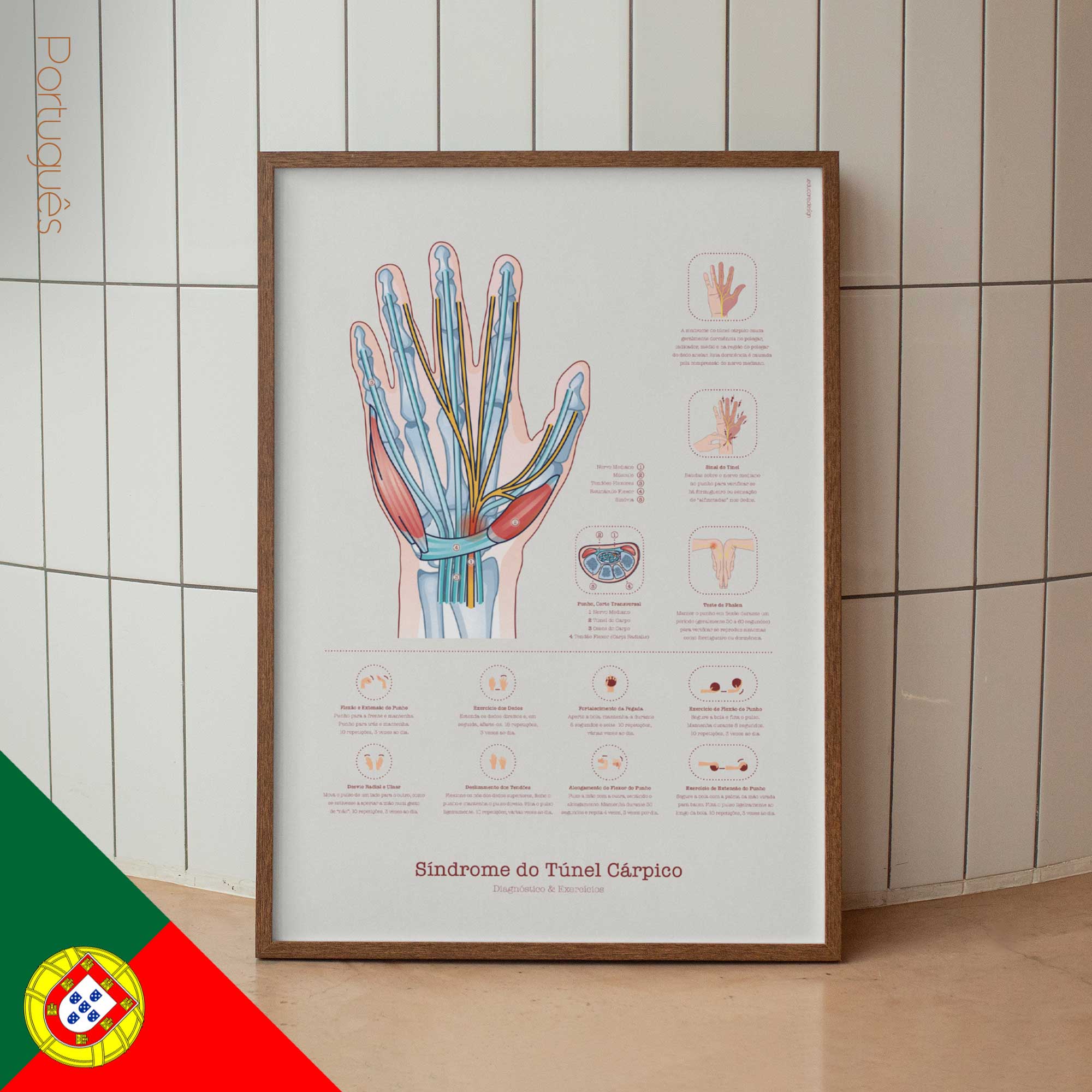 Carpal Tunnel Syndrome with Diagnosis and Exercises