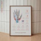 Carpal Tunnel Syndrome with Diagnosis and Exercises