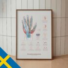 Carpal Tunnel Syndrome with Diagnosis and Exercises