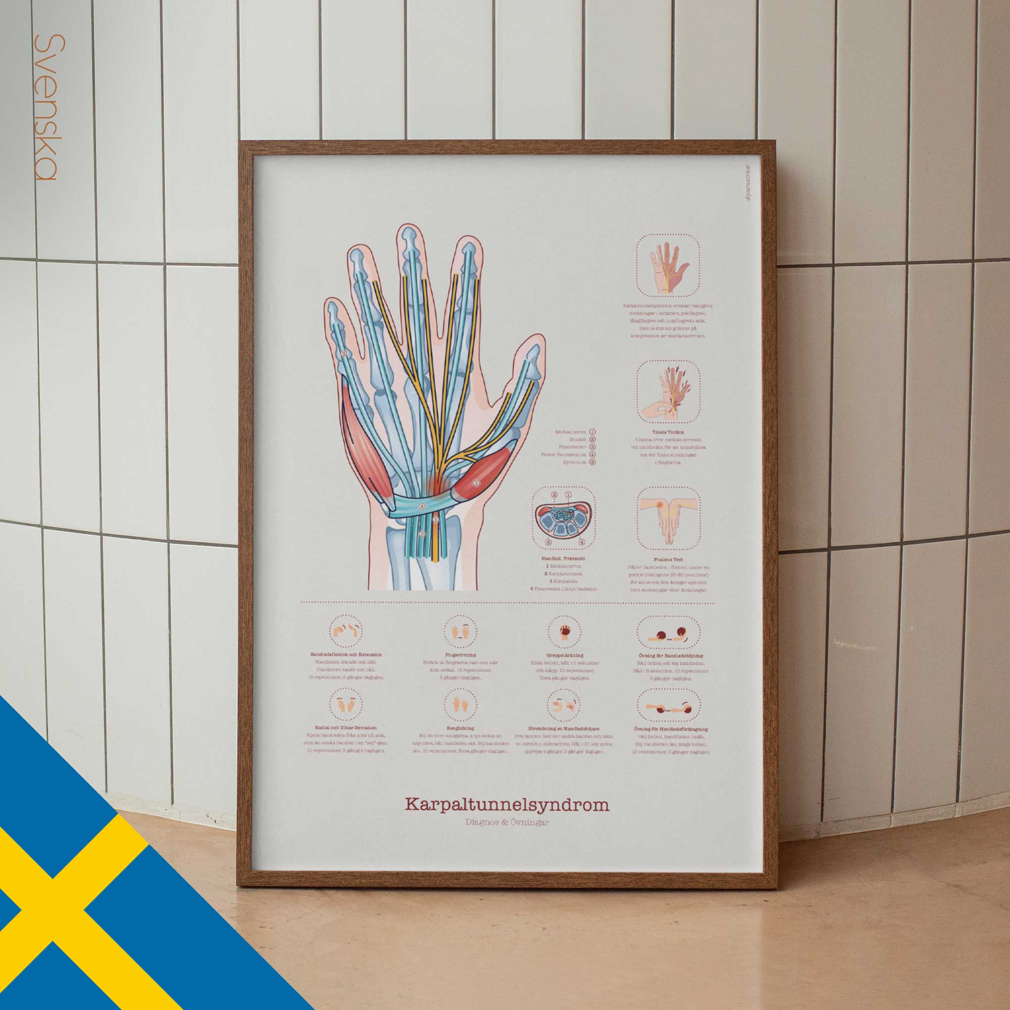 Carpal Tunnel Syndrome with Diagnosis and Exercises