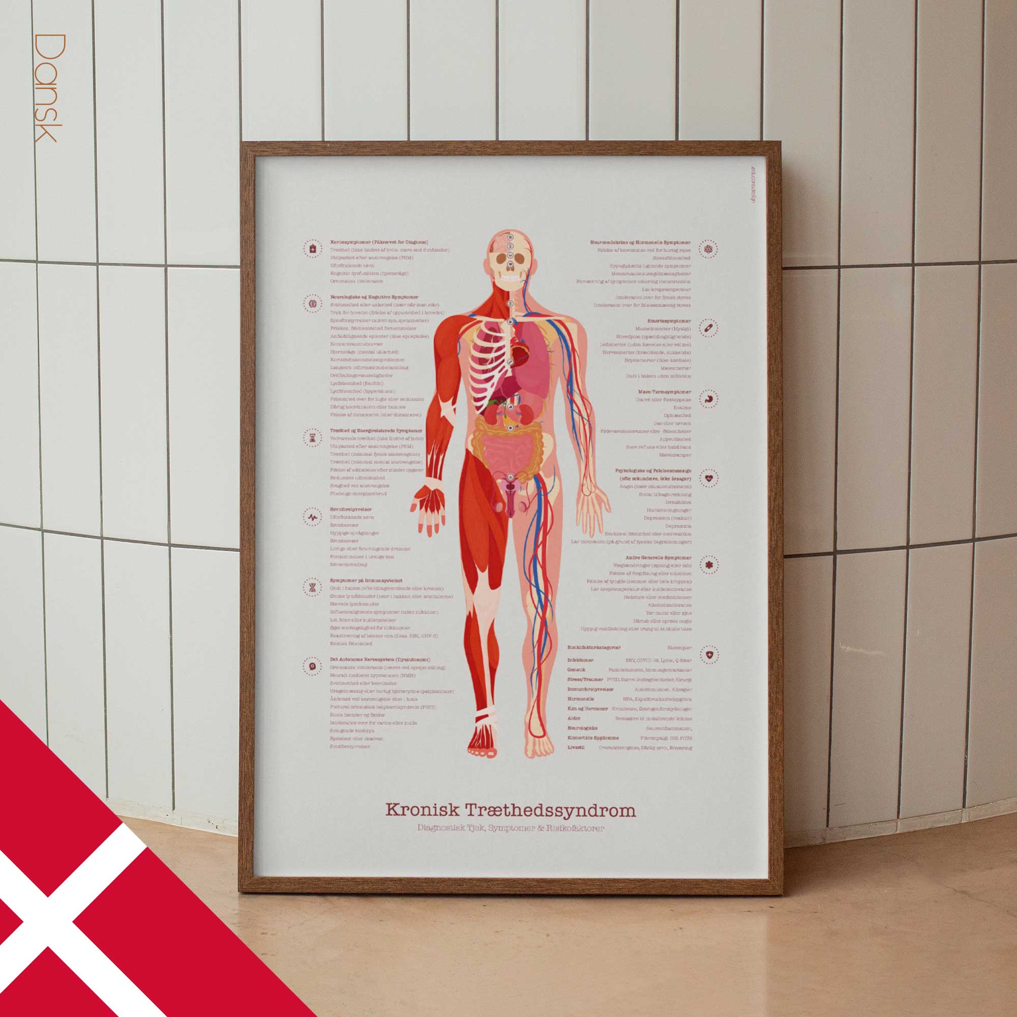 Chronic Fatigue Sindrome chart with Diagnostic Check, Common Symptoms & Risk Factors