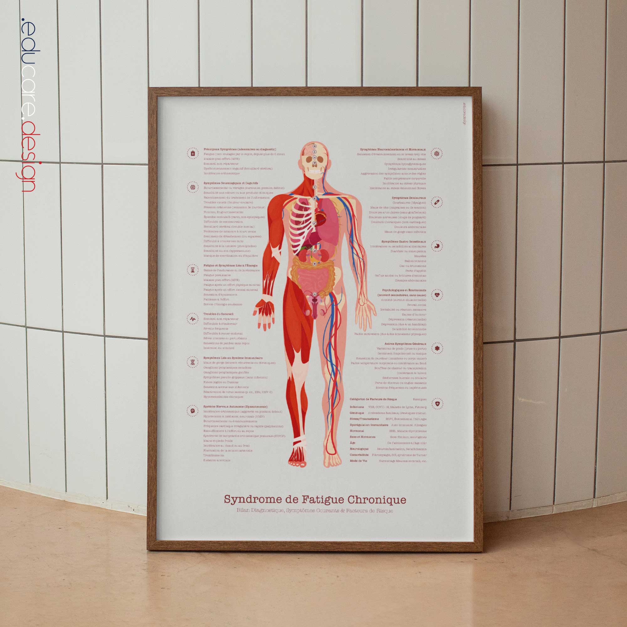 Chronic Fatigue Sindrome chart with Diagnostic Check, Common Symptoms & Risk Factors