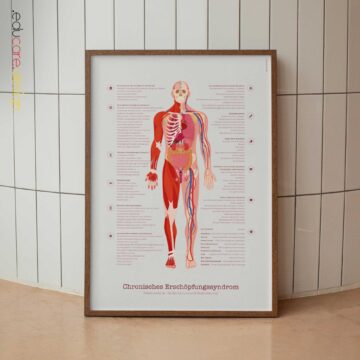 Diagramm zum CES mit Diagnosecheck, häufigen Symptomen und Risikofaktoren.