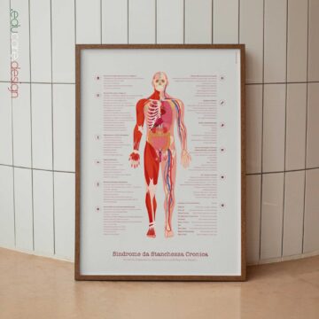 Grafico della sindrome da fatica cronica con controllo diagnostico, sintomi comuni e fattori di rischio