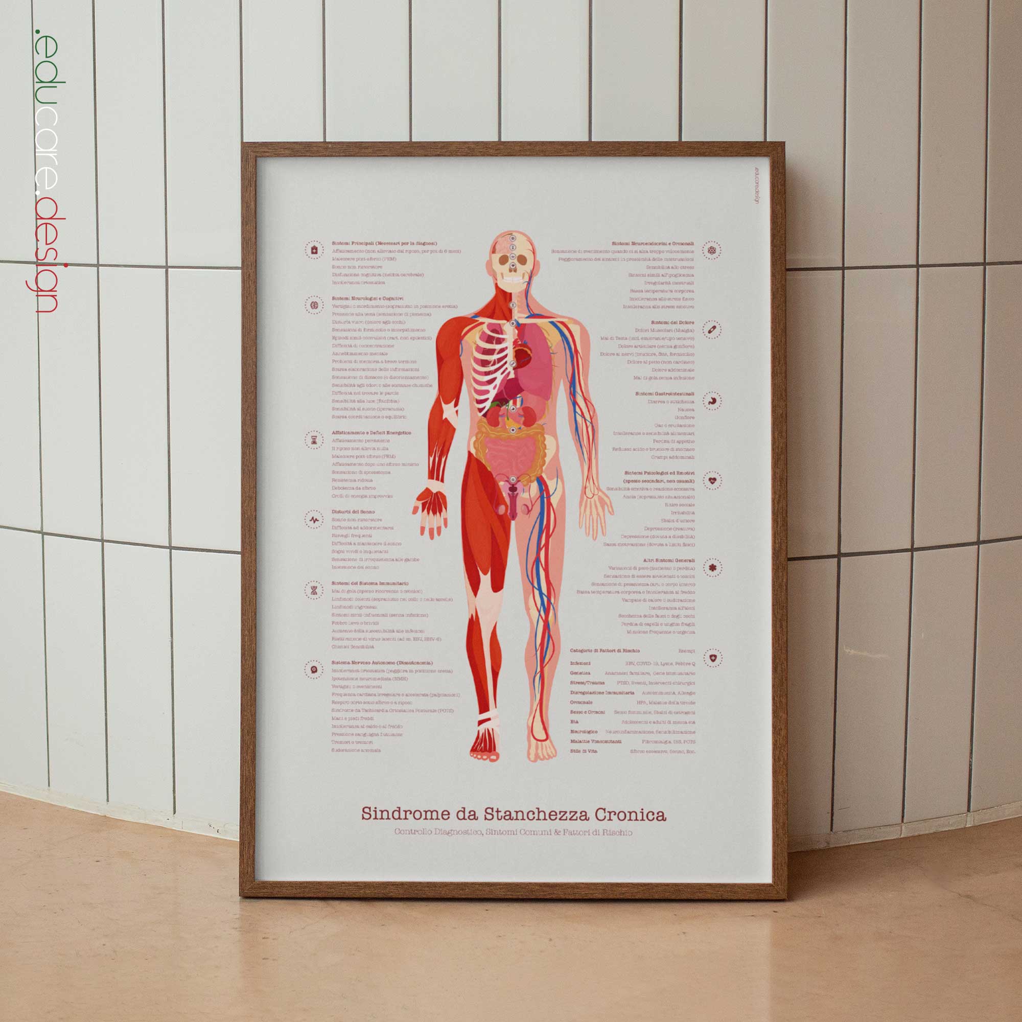 Grafico della sindrome da fatica cronica con controllo diagnostico, sintomi comuni e fattori di rischio