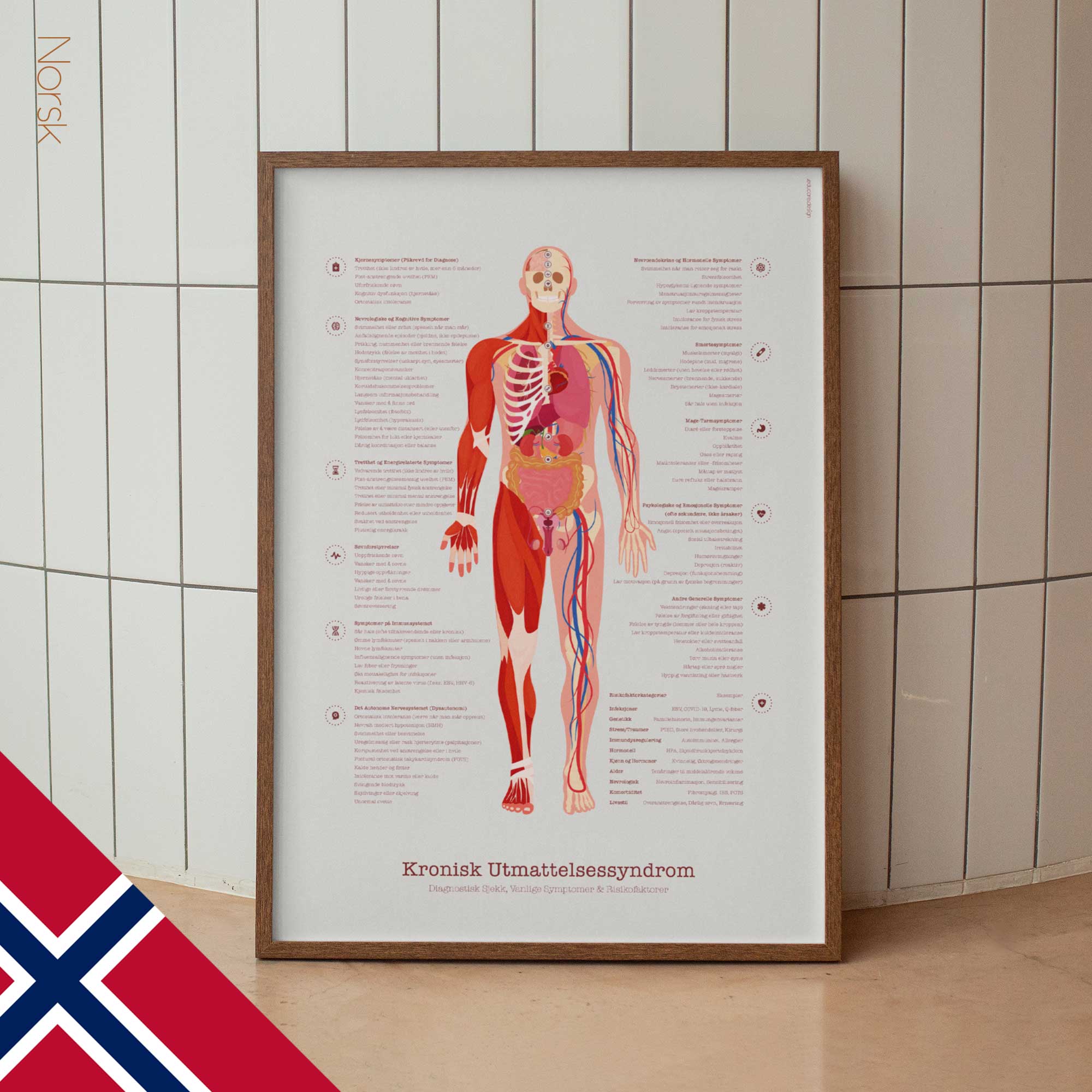 Chronic Fatigue Sindrome chart with Diagnostic Check, Common Symptoms & Risk Factors