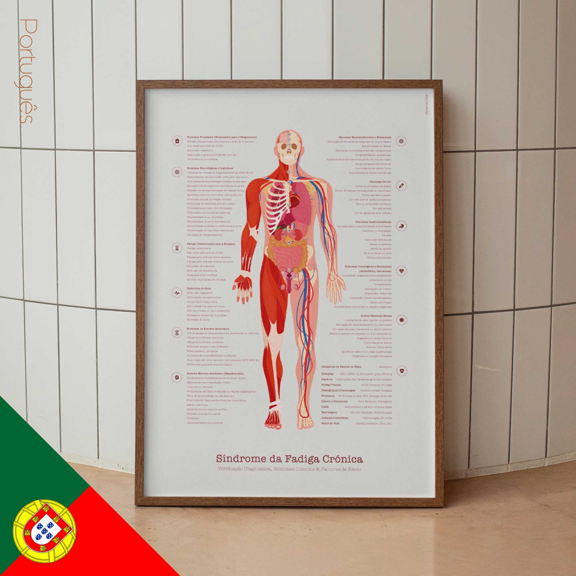 Chronic Fatigue Sindrome chart with Diagnostic Check, Common Symptoms & Risk Factors