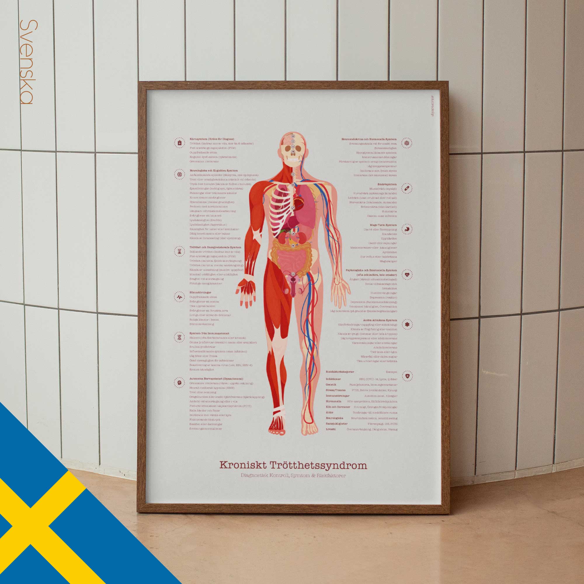 Chronic Fatigue Sindrome chart with Diagnostic Check, Common Symptoms & Risk Factors