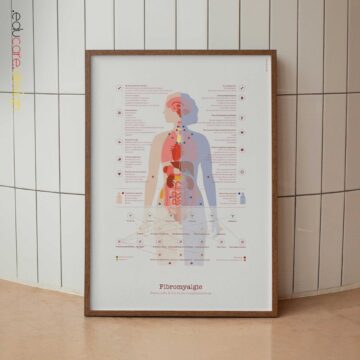 Fibromyalgie mit Hormonellen und das Nervensystem Systemverbindungen