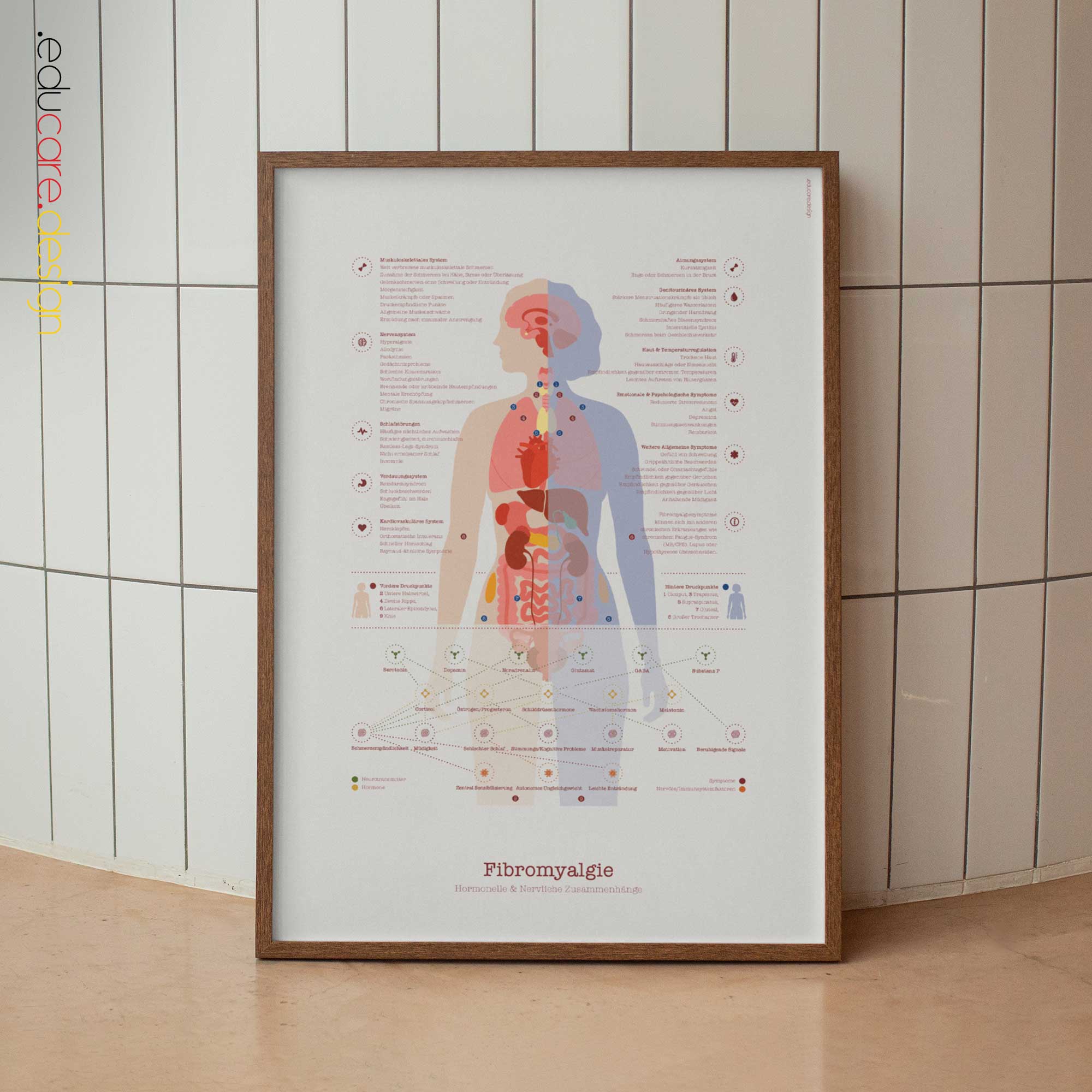 Fibromyalgie mit Hormonellen und das Nervensystem Systemverbindungen Anatomie-Chart für Praxen und Kliniken