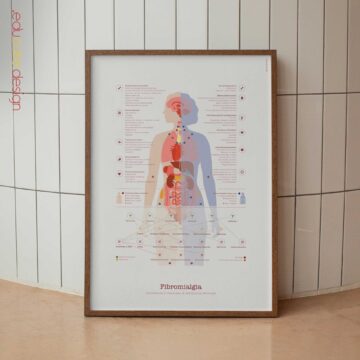 Fibromialgia con Conexiones Hormonales y del Sistema Nervioso