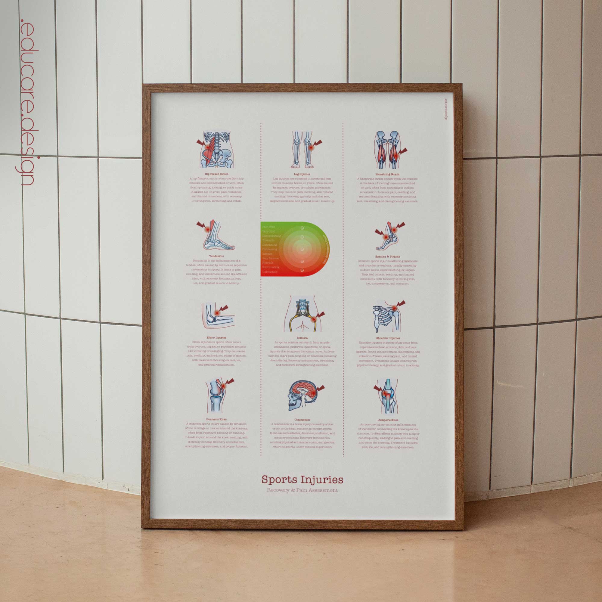 Sports Injuries anatomy chart for clinics Sports Injuries anatomy chart for clinics