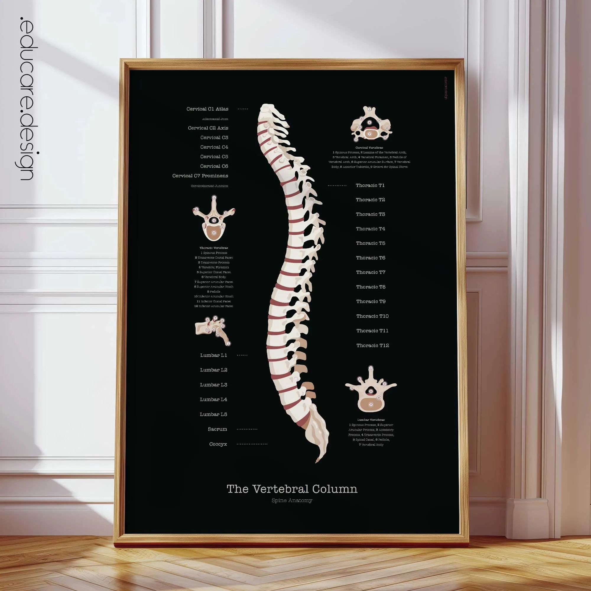 TMJ Disorder anatomy chart for clinics TMJ Disorder anatomy chart for clinics