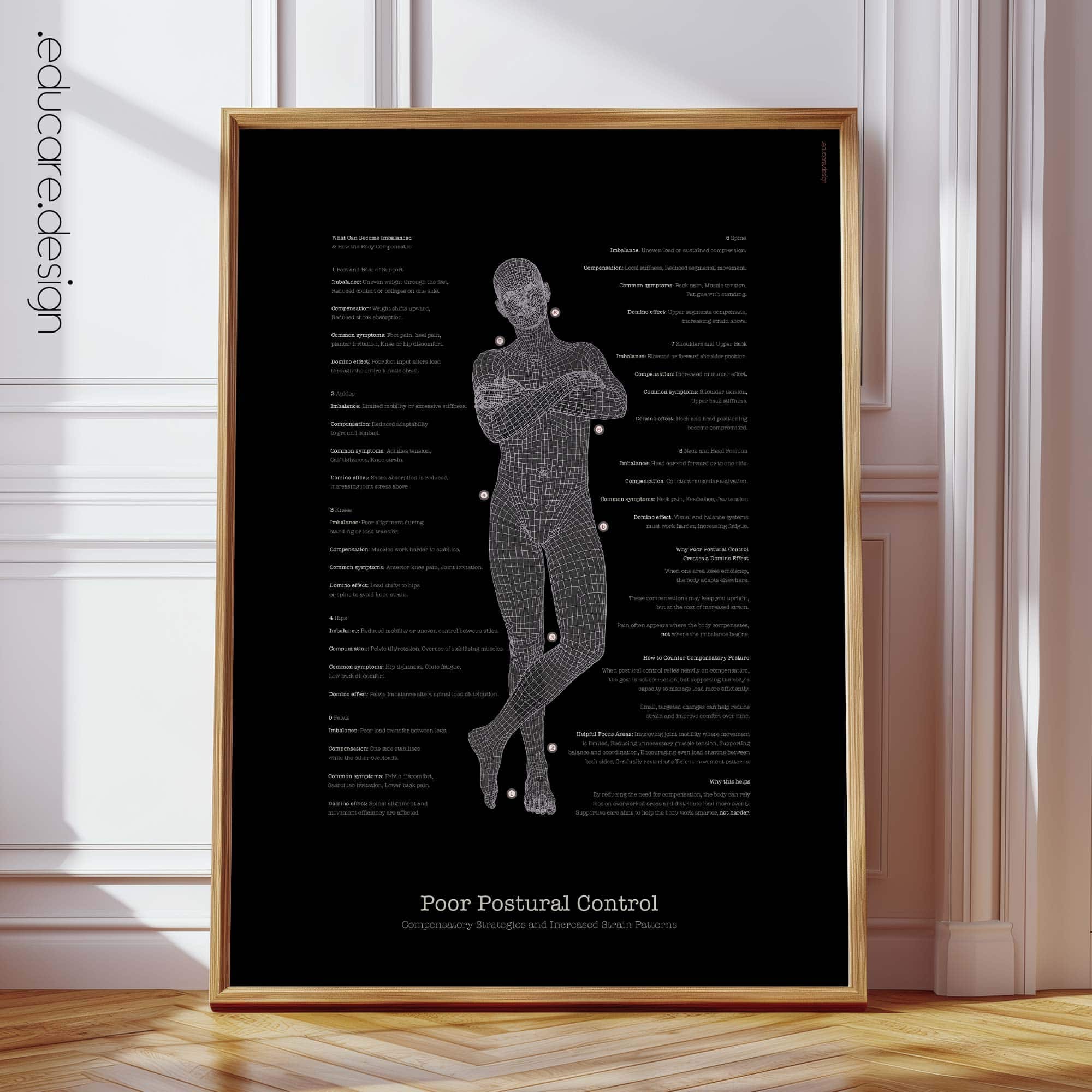 Poor Postural Control & Load Distribution | Posture Education Chart