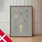 Iskiassmerter – Quick Guide anatomidiagram til klinikker