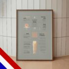 Ischiaspijn – Quick Guide anatomisch diagram voor praktijken en klinieken