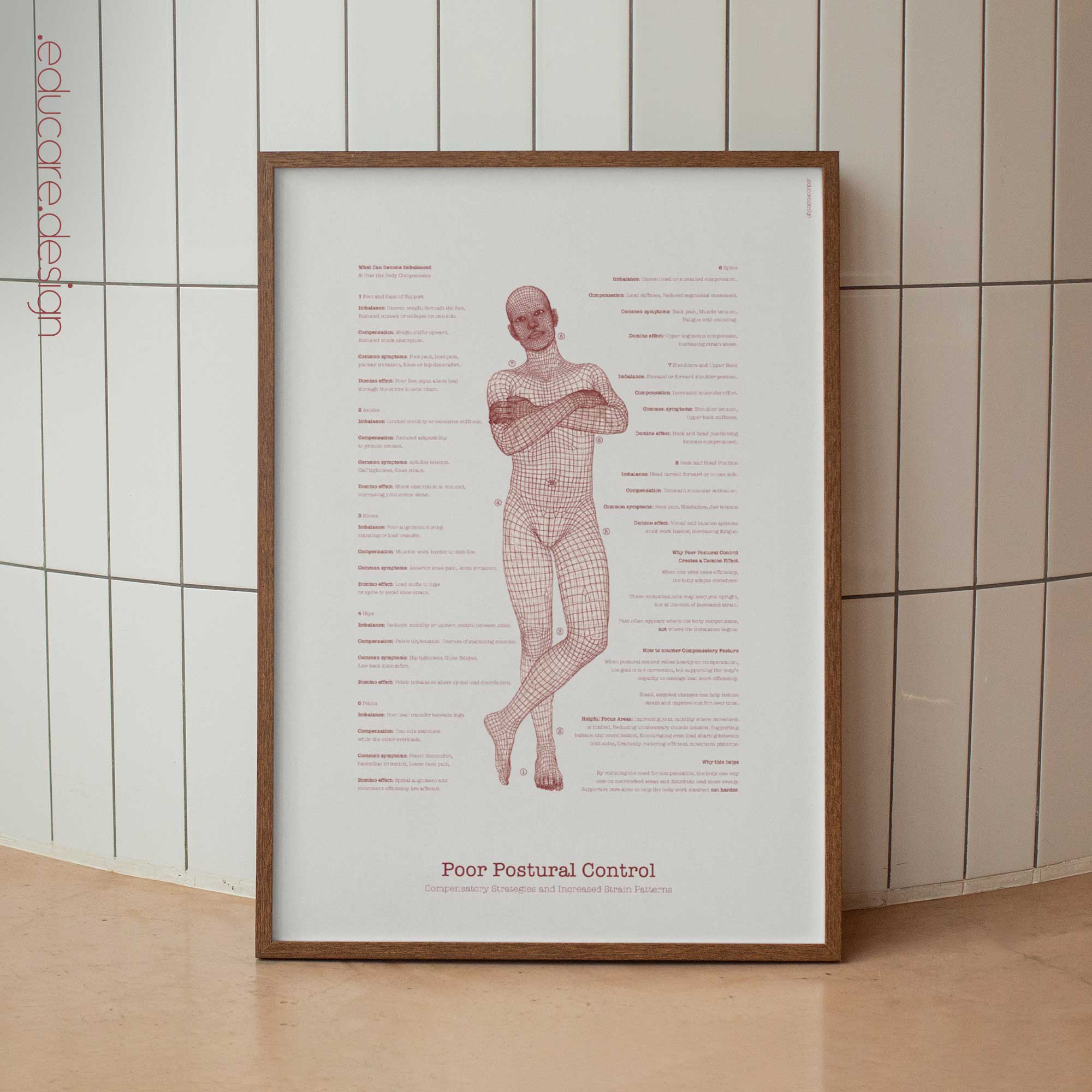 Poor Postural Control anatomy chart for clinics
