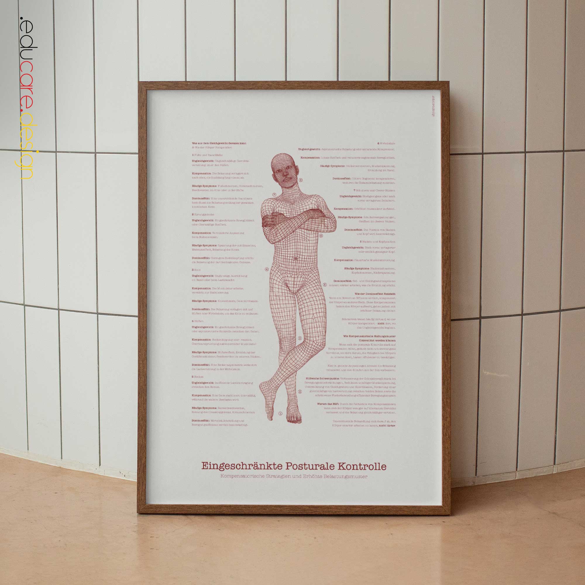 Eingeschränkte Haltungskontrolle Anatomie-Chart für Praxen und Kliniken