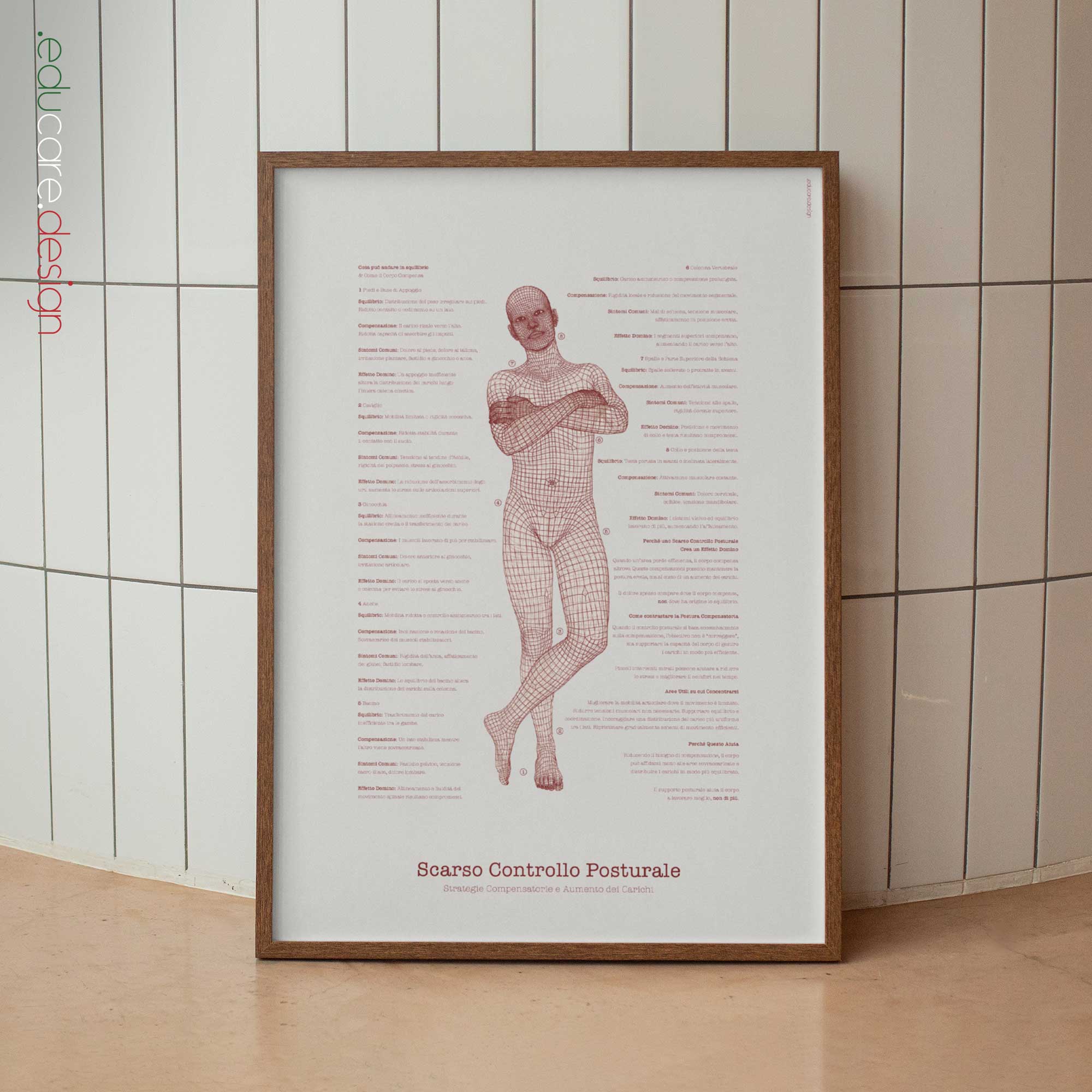 Scarso Controllo Posturale tavola anatomica per studi e cliniche