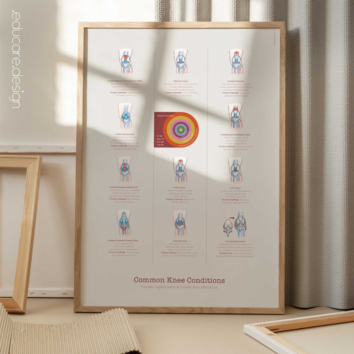 Patient-friendly knee conditions chart illustrating common injuries, degeneration, and altered joint mechanics.