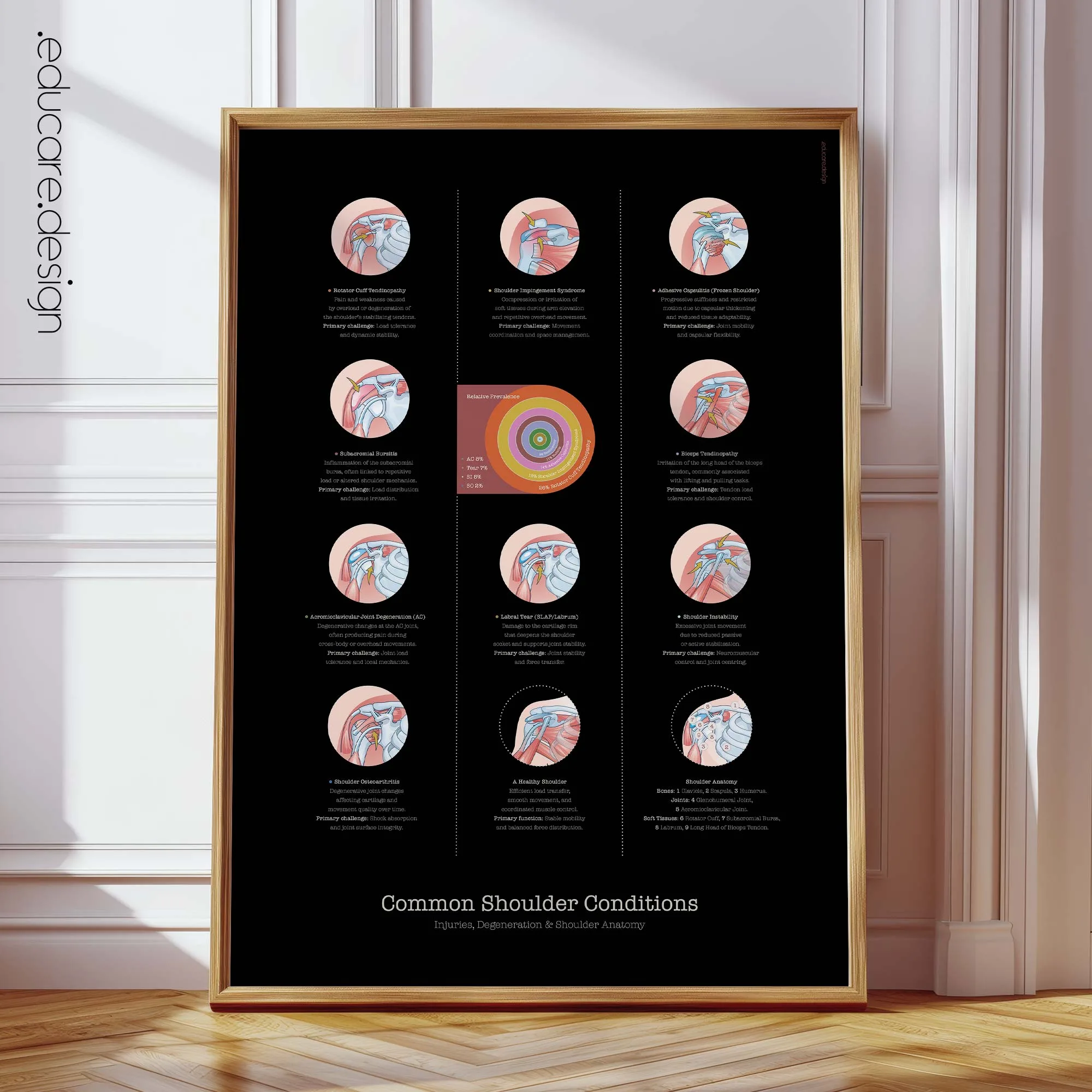 Common Shoulder Conditions anatomy chart for clinics
