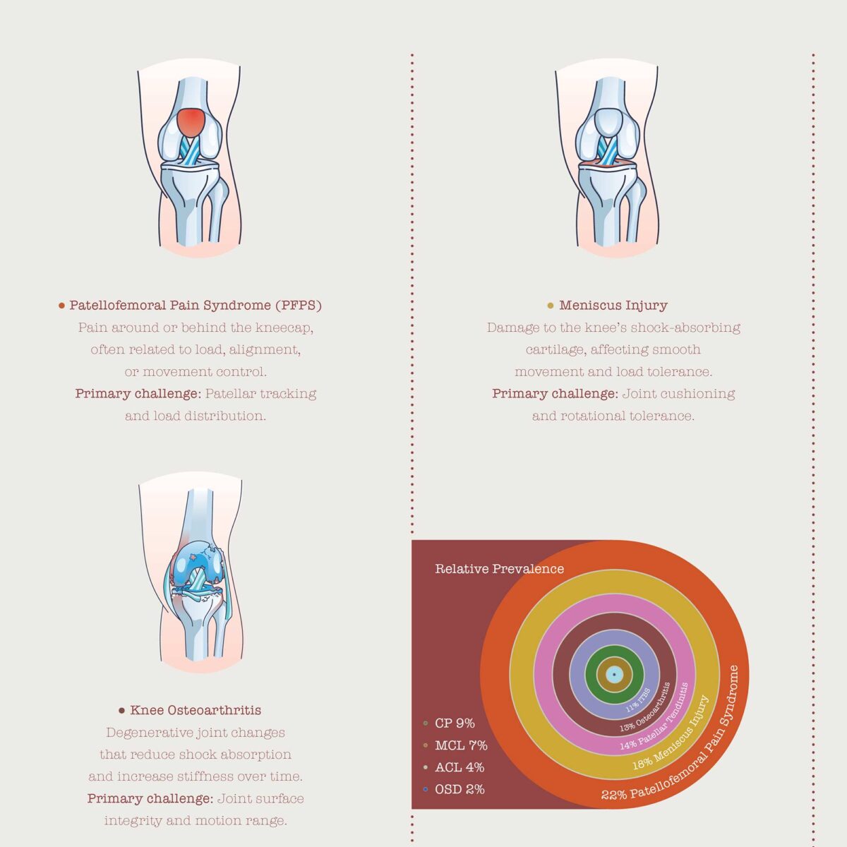 Patient-friendly knee conditions chart illustrating common injuries, degeneration, and altered joint mechanics.