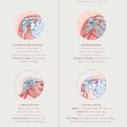 Common Shoulder Conditions anatomy chart for clinics