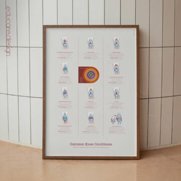 Patient-friendly knee conditions chart illustrating common injuries, degeneration, and altered joint mechanics.