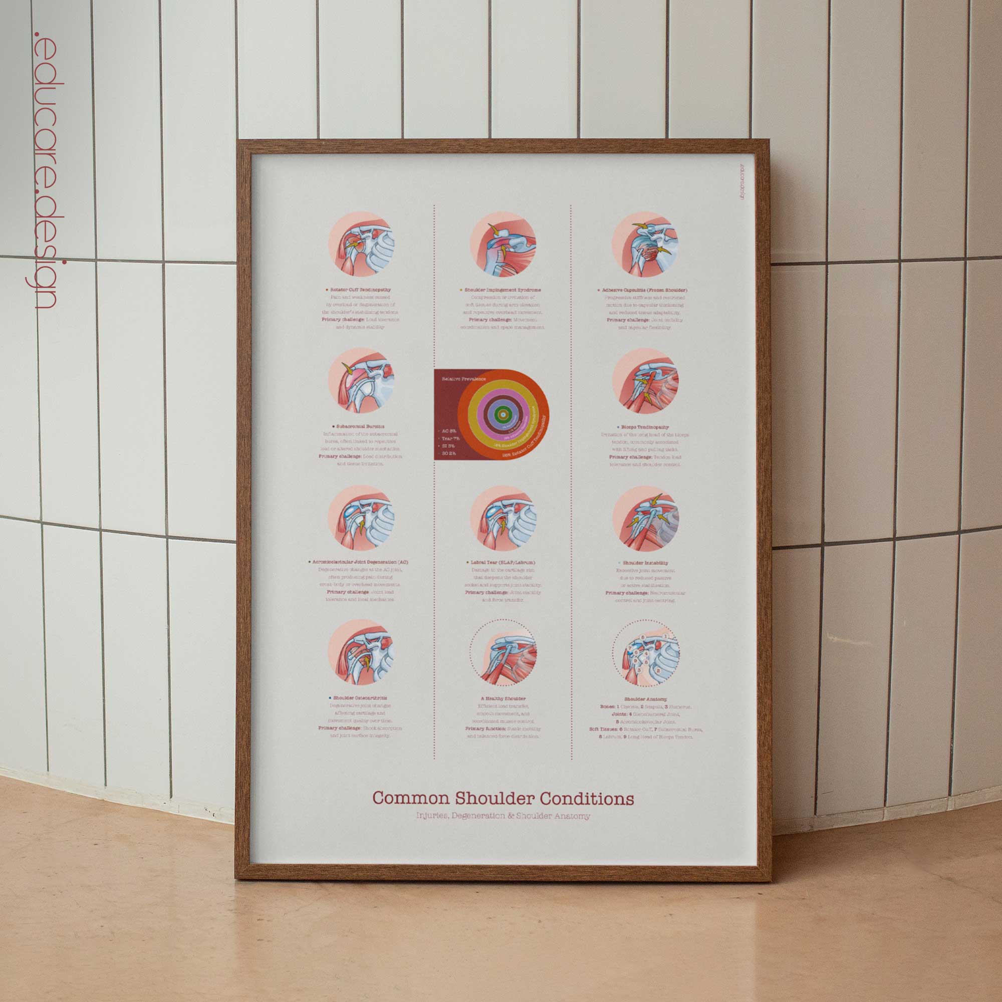 Common Shoulder Conditions Anatomy Chart