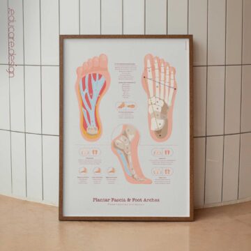 Plantar fascia and foot arches anatomy chart showing plantar aponeurosis, skeletal arch framework and arch profiles.