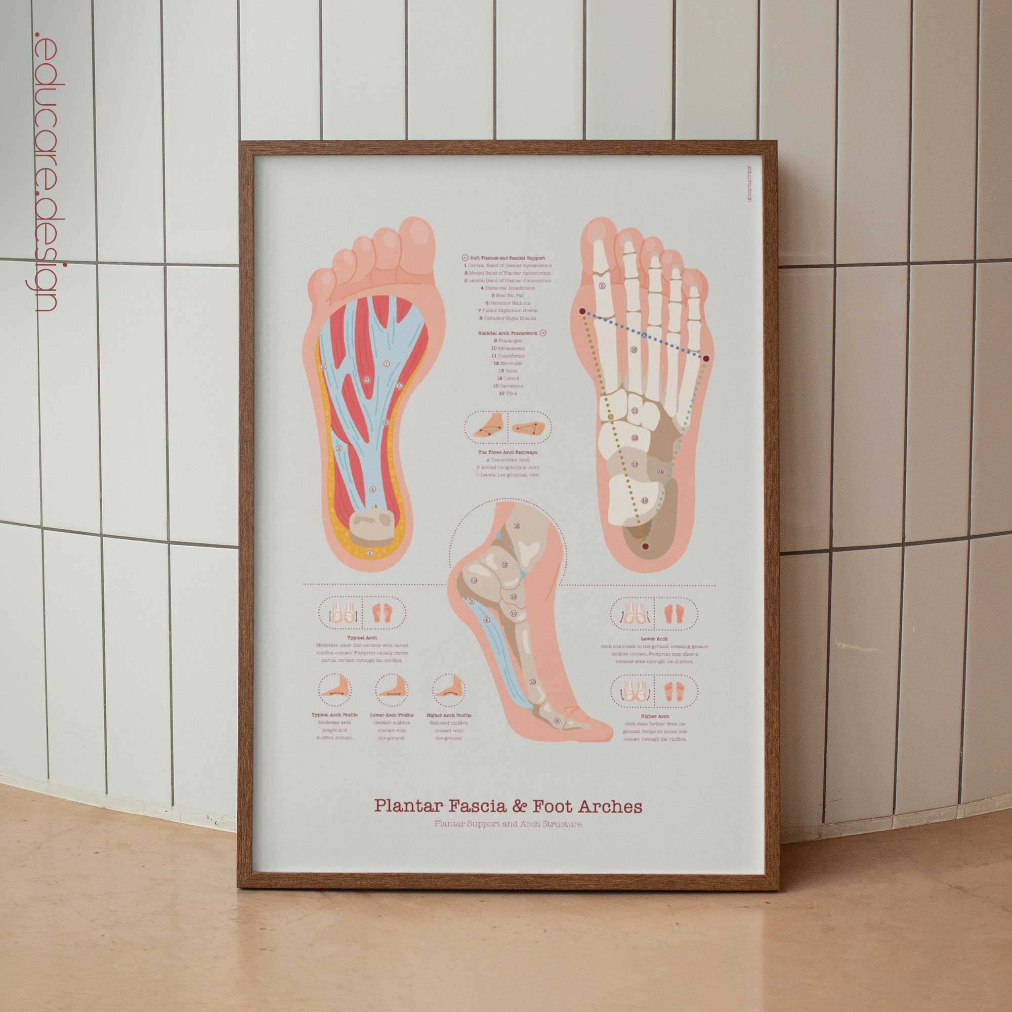 Plantar Fascia and Foot Arches anatomy chart for clinics