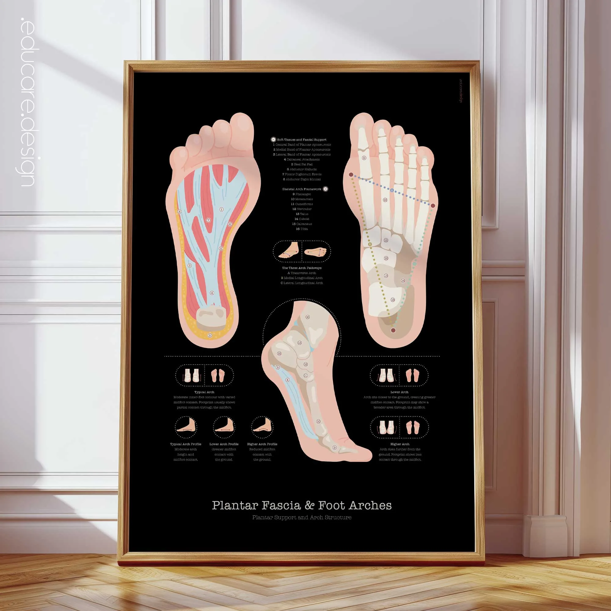 Plantar fascia and foot arches anatomy chart - Black Edition